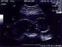 Pregnancy Pictures
